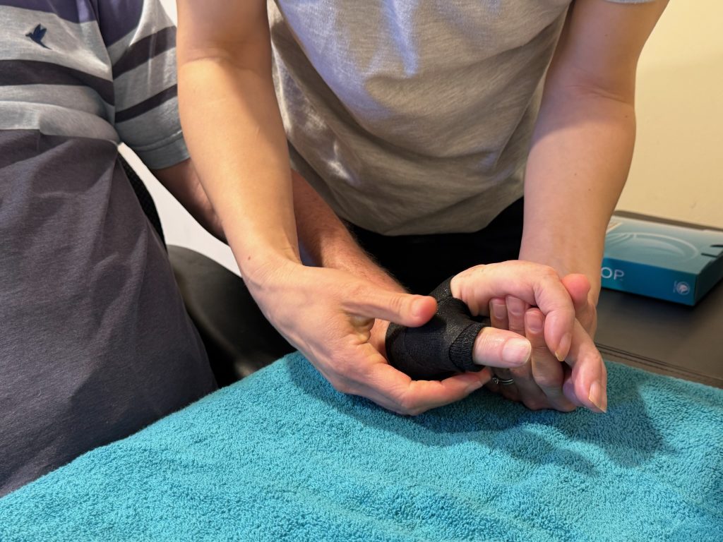 close up of Hand splint Occupational therapist Rachel has created on peters hand