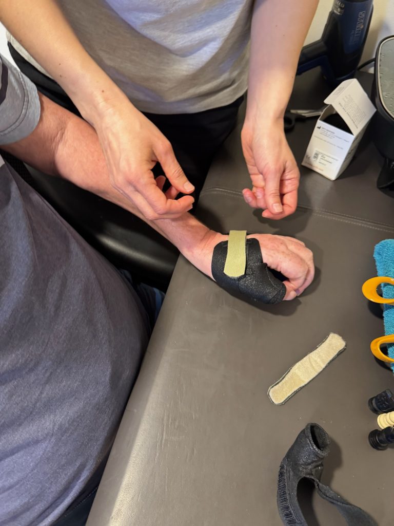 close up of OT rachel fitting the new splint she made to peters hand